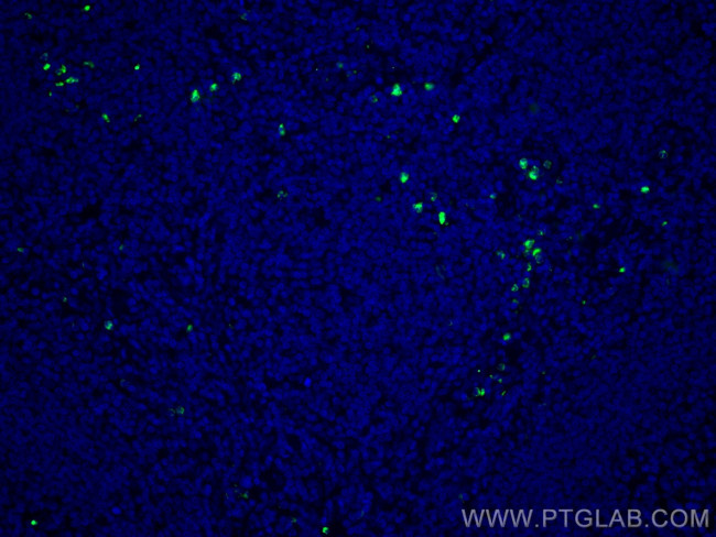 PRTN3 Antibody in Immunohistochemistry (Paraffin) (IHC (P))