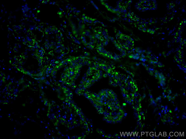 GUK1 Antibody in Immunohistochemistry (Paraffin) (IHC (P))