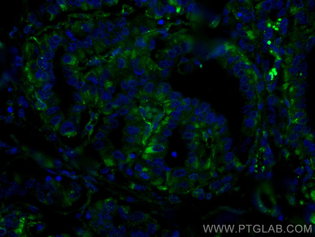 GUK1 Antibody in Immunohistochemistry (Paraffin) (IHC (P))