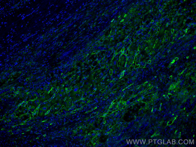 Endoglin/CD105 Antibody in Immunohistochemistry (Paraffin) (IHC (P))