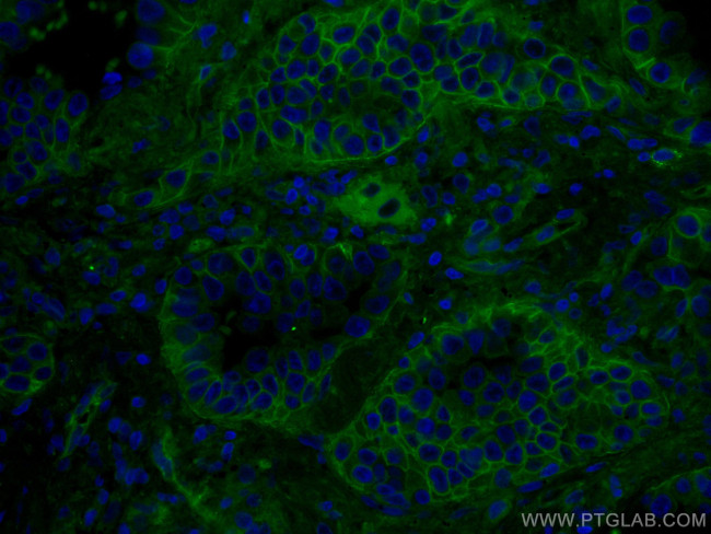 RALB Antibody in Immunohistochemistry (Paraffin) (IHC (P))