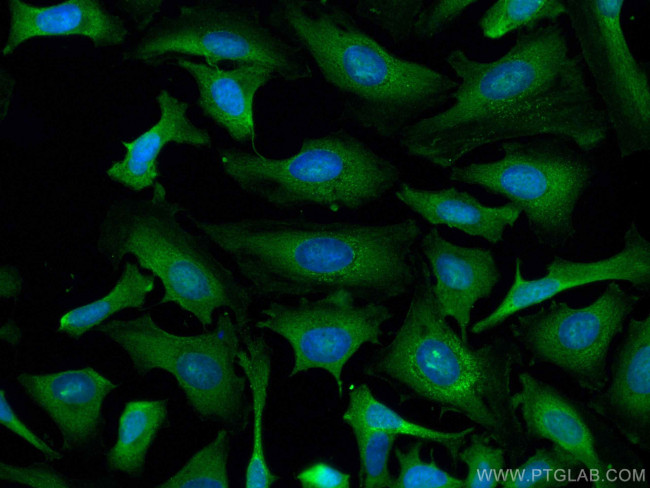 Calpastatin Antibody in Immunocytochemistry (ICC/IF)