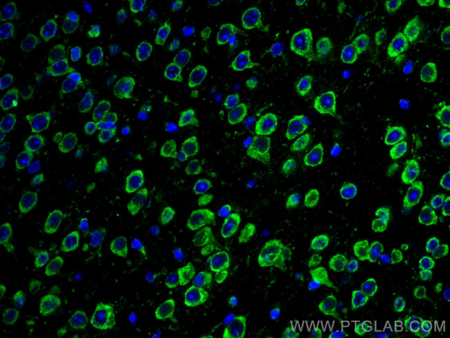 L1CAM Antibody in Immunohistochemistry (Paraffin) (IHC (P))