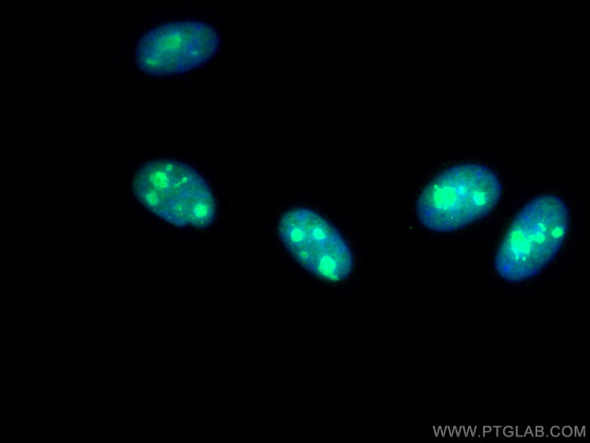 DHX9 Antibody in Immunocytochemistry (ICC/IF)