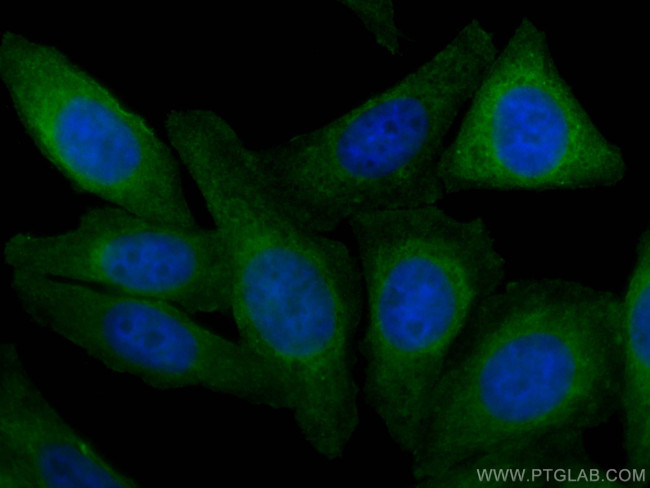 HSF1 Antibody in Immunocytochemistry (ICC/IF)