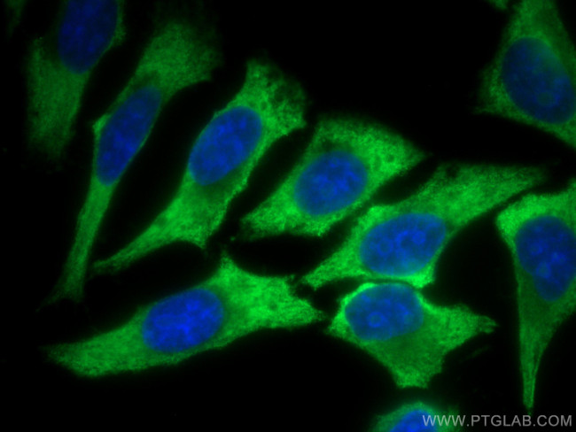 EIF4G1 Antibody in Immunocytochemistry (ICC/IF)