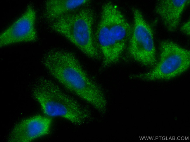 PEPD Antibody in Immunocytochemistry (ICC/IF)