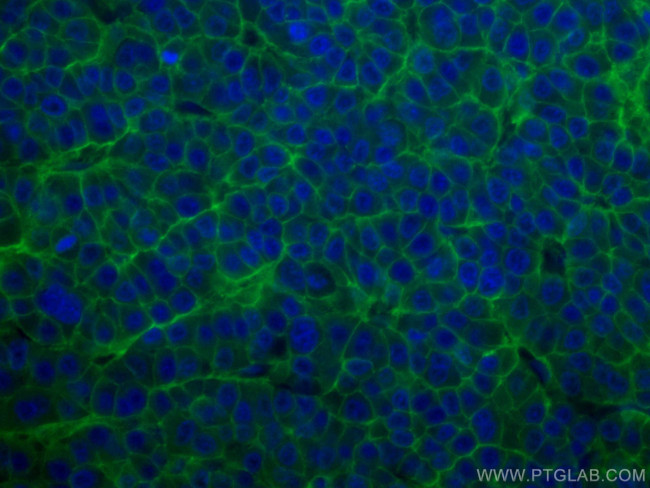 SLC31A1 Antibody in Immunohistochemistry (Paraffin) (IHC (P))