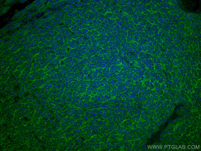 SLC31A1 Antibody in Immunohistochemistry (Paraffin) (IHC (P))