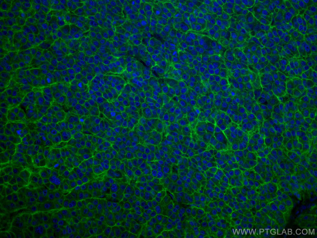 SLC31A1 Antibody in Immunohistochemistry (Paraffin) (IHC (P))