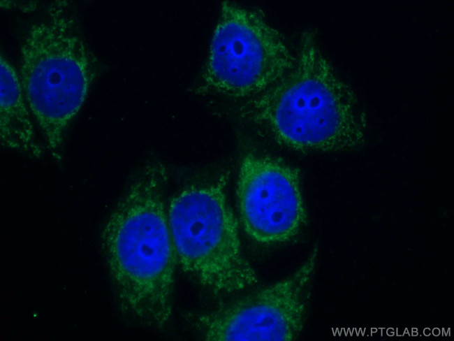 NQO1 Antibody in Immunocytochemistry (ICC/IF)