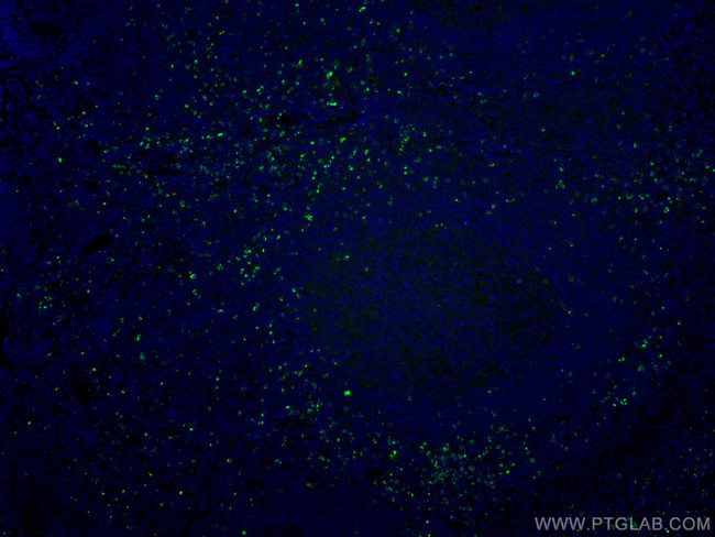 Granzyme K Antibody in Immunohistochemistry (Paraffin) (IHC (P))