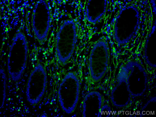 Collagen Type I Antibody in Immunohistochemistry (Paraffin) (IHC (P))