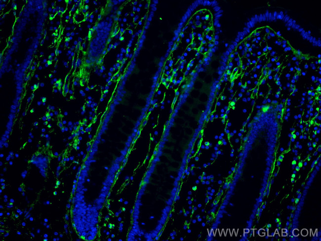 Collagen Type I Antibody in Immunohistochemistry (Paraffin) (IHC (P))