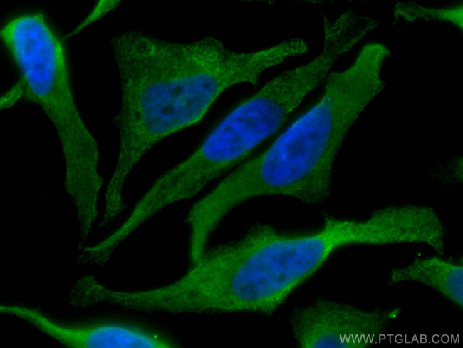 TRIM25 Antibody in Immunocytochemistry (ICC/IF)