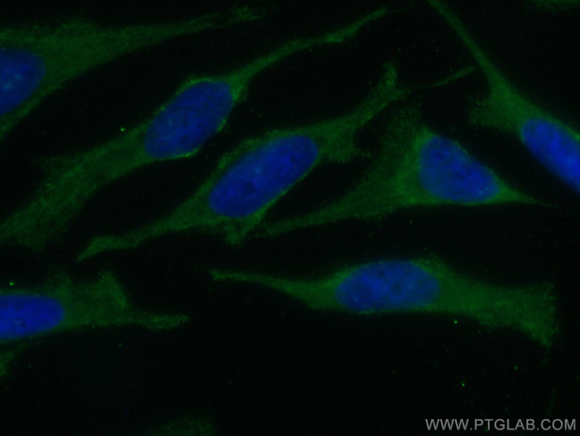 TRAF2 Antibody in Immunocytochemistry (ICC/IF)