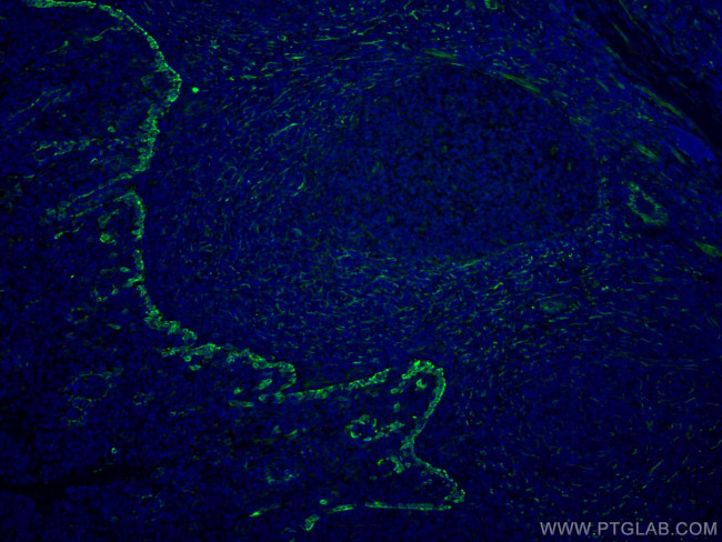 TLR8 Antibody in Immunohistochemistry (Paraffin) (IHC (P))