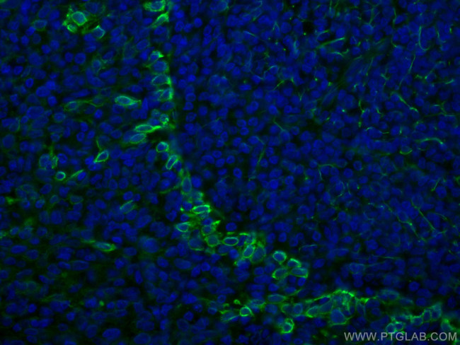 TLR8 Antibody in Immunohistochemistry (Paraffin) (IHC (P))