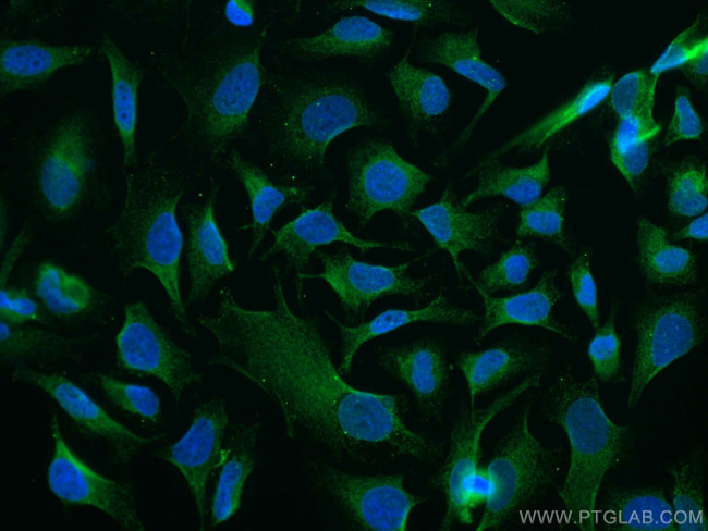 GSK3B Antibody in Immunocytochemistry (ICC/IF)