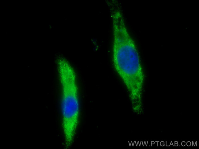 PSMD9 Antibody in Immunocytochemistry (ICC/IF)