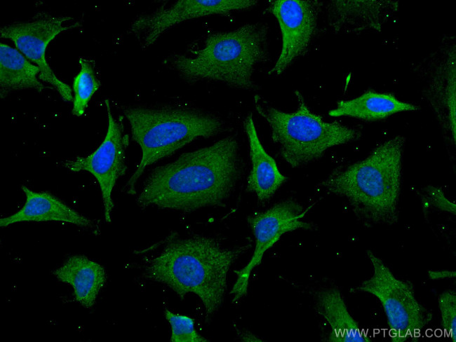 PSMD9 Antibody in Immunocytochemistry (ICC/IF)