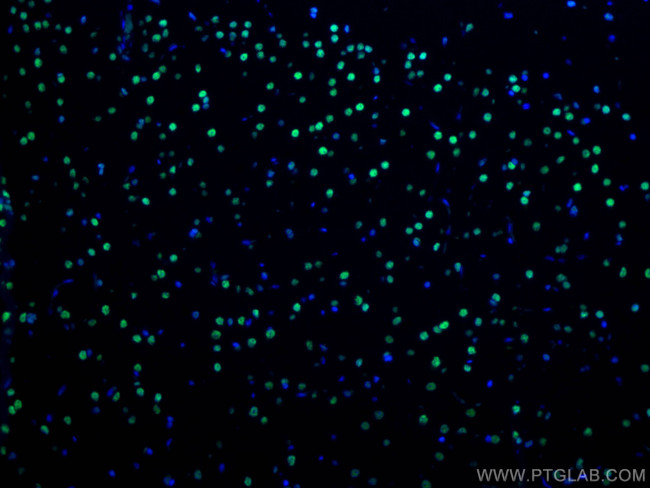 TDP-43 Antibody in Immunohistochemistry (Paraffin) (IHC (P))