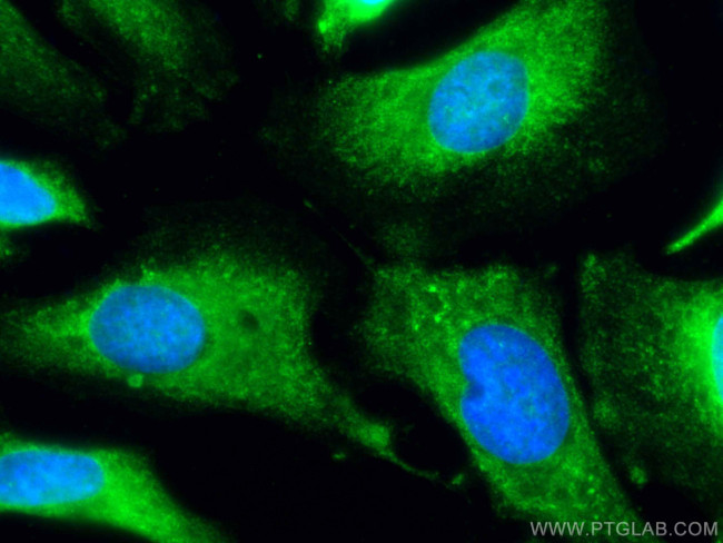 PTGS1 Antibody in Immunocytochemistry (ICC/IF)