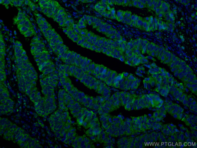 TSG101 Antibody in Immunohistochemistry (Paraffin) (IHC (P))