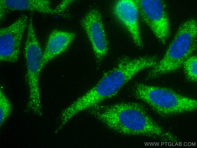 FGL1 Antibody in Immunocytochemistry (ICC/IF)