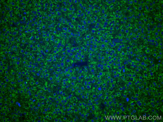 LACTB2 Antibody in Immunohistochemistry (Paraffin) (IHC (P))