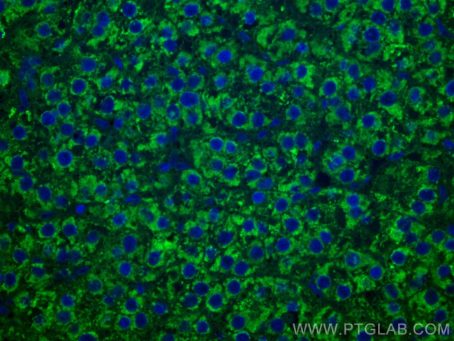 LACTB2 Antibody in Immunohistochemistry (Paraffin) (IHC (P))