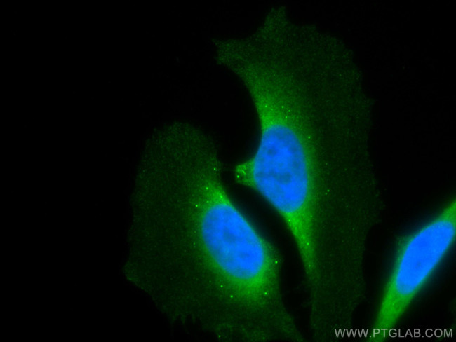 MEK2 Antibody in Immunocytochemistry (ICC/IF)