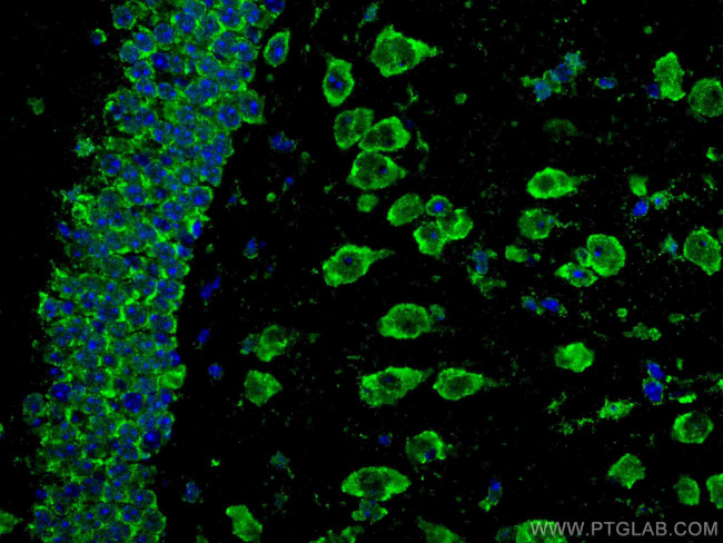 ACVR1 Antibody in Immunohistochemistry (Paraffin) (IHC (P))