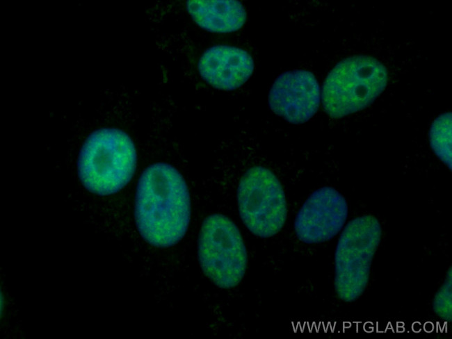 RBM39 Antibody in Immunocytochemistry (ICC/IF)