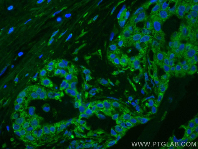 KLK11 Antibody in Immunohistochemistry (Paraffin) (IHC (P))