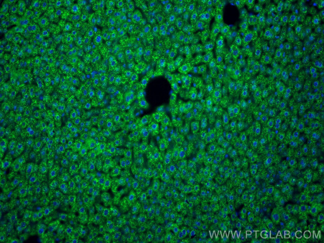 BDH1 Antibody in Immunohistochemistry (Paraffin) (IHC (P))