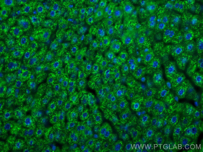 BDH1 Antibody in Immunohistochemistry (Paraffin) (IHC (P))