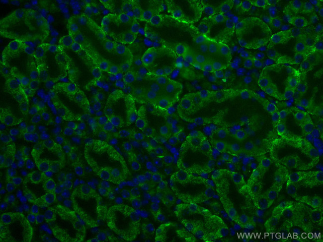 Arfaptin-1 Antibody in Immunohistochemistry (Paraffin) (IHC (P))