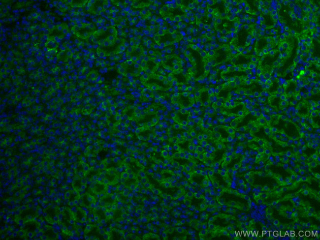 Arfaptin-1 Antibody in Immunohistochemistry (Paraffin) (IHC (P))