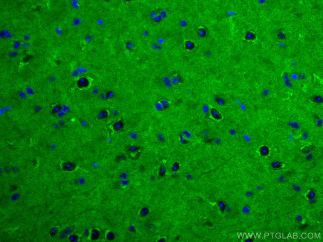 RAB2A Antibody in Immunohistochemistry (Paraffin) (IHC (P))