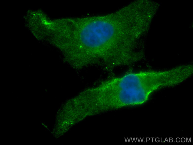 BSEP Antibody in Immunocytochemistry (ICC/IF)