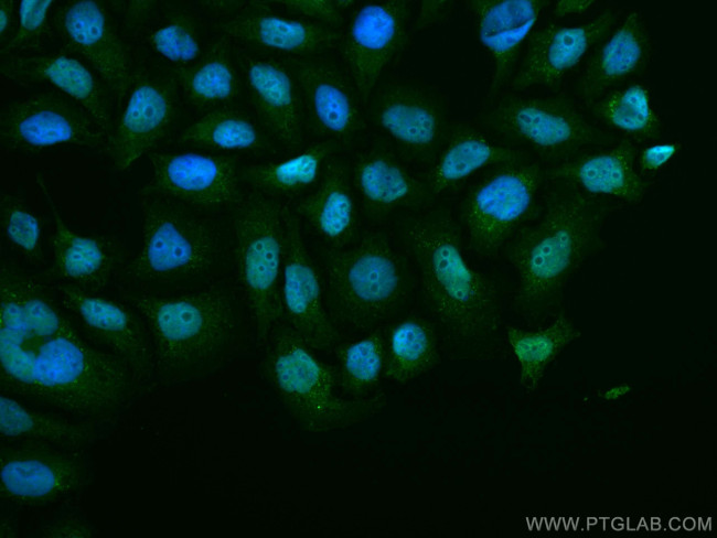 PDS5A Antibody in Immunocytochemistry (ICC/IF)