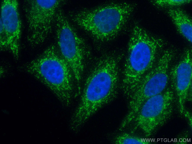 Tim23 Antibody in Immunocytochemistry (ICC/IF)