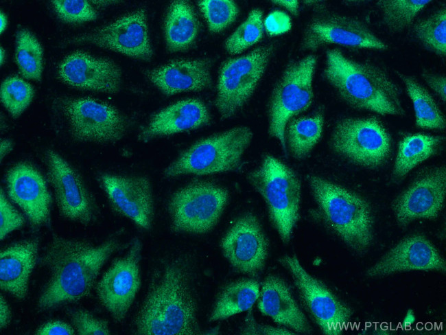 RHOC Antibody in Immunocytochemistry (ICC/IF)