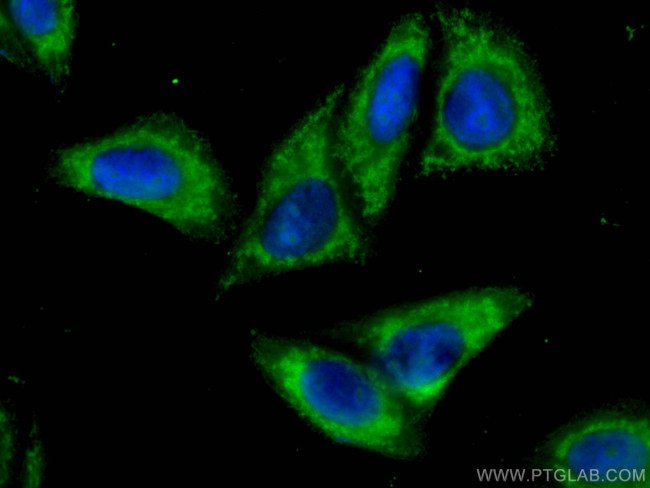 RIG-1/DDX58 Antibody in Immunocytochemistry (ICC/IF)