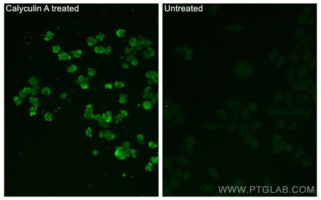 Phospho-GSK3B (Ser9) Antibody in Immunocytochemistry (ICC/IF)