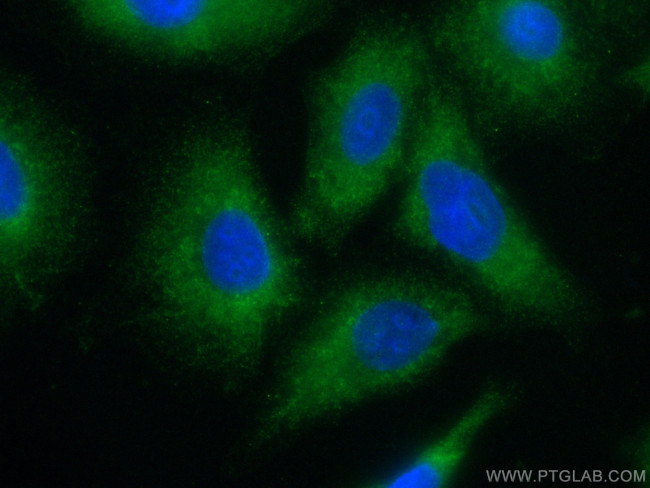 VPS18 Antibody in Immunocytochemistry (ICC/IF)