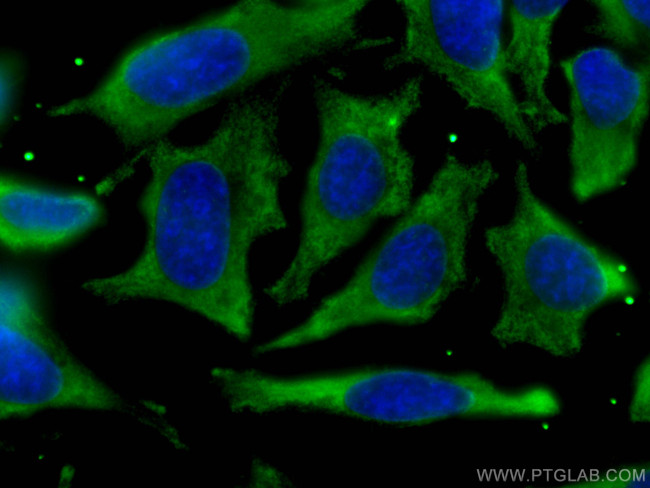 PHGDH Antibody in Immunocytochemistry (ICC/IF)