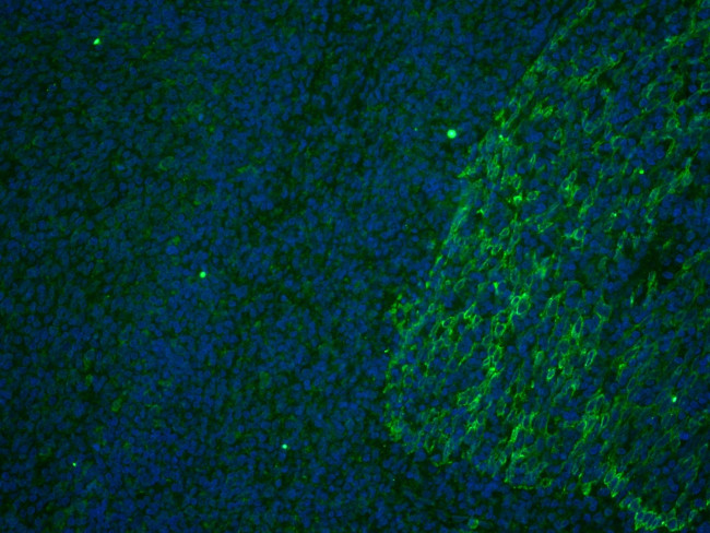 CD63 Antibody in Immunohistochemistry (Paraffin) (IHC (P))