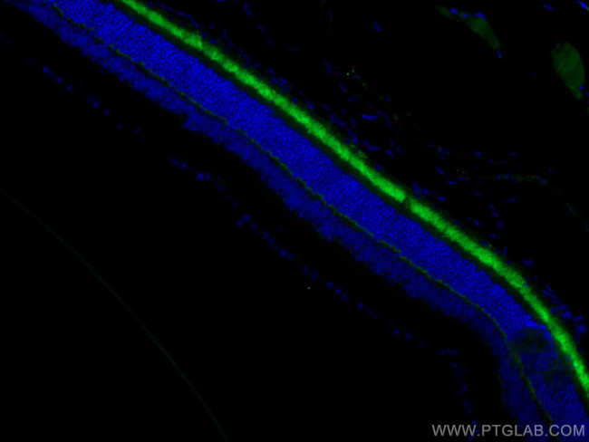 ANO2 Antibody in Immunohistochemistry (Paraffin) (IHC (P))